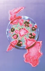 AI_Disease_Vert.jpg.webp
