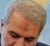 forehead.jpg